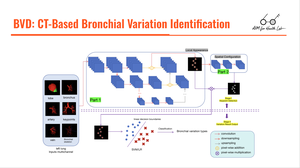 BVD: A Two-Stage Network for Identifying Bronchial Variation Types from CT Images